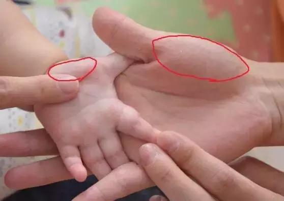 宝宝脾虚消化不良积食的推拿视频,婴儿消化不良拉奶瓣怎么调理推拿