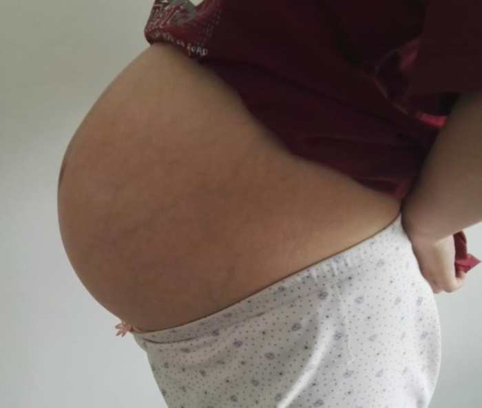 一层层，一刀刀切开孕妇肚子，剖腹产并不是你想象的那么简单