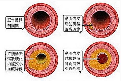 血稠吃什么药通血管有效,血稠吃什么食物能清理血管垃圾