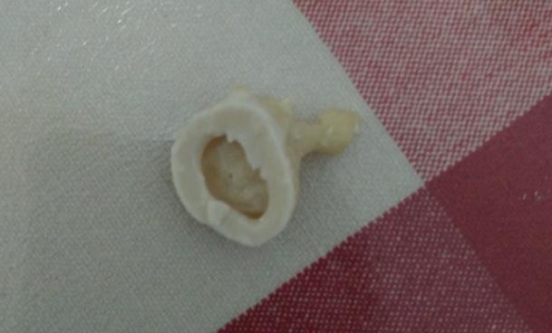 家长们别纠结选哪个奶粉品牌了,奶粉选哪款好一些