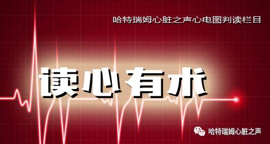 读心有术216,心电图出现双尖心室肥大