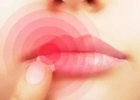 外出踏青要关注什么安全,清明踏青皮肤过敏