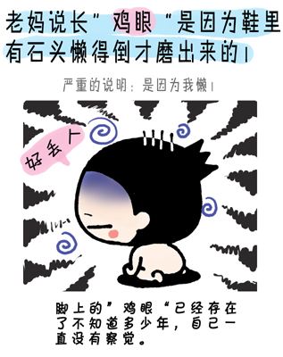 脚上长鸡眼有什么好办法去除,鸡眼是怎么形成的有什么方法治