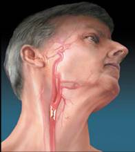 改善脑供血不够的药有哪些,脑供血不够常敲打3个穴位