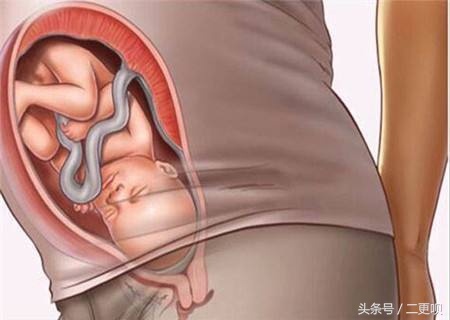 孕晚期胃不舒服别人怎么帮忙缓解,怎样缓解孕晚期胃部不适