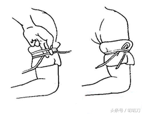 刀割伤正确急救方法有哪些,刀割伤该如何止血