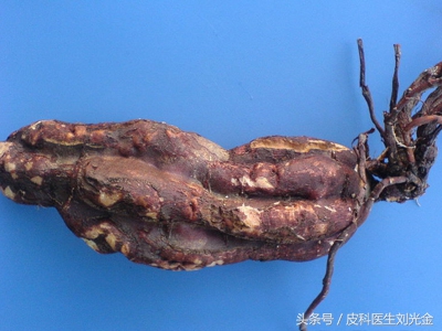 常见的有治愈作用的植物,哪种植物叶子能治皮肤病