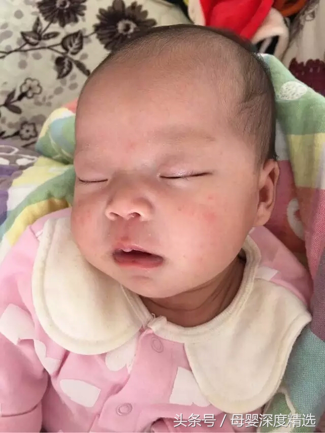 婴儿面部湿疹怎么护理效果最好,宝宝湿疹流脓结痂的部分怎么护理