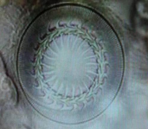 鱼友必知的鱼缸藻类防治秘籍,鱼友分享鱼病大全