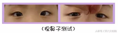 怎么辨别孩子是不是对眼,孩子是不是对眼