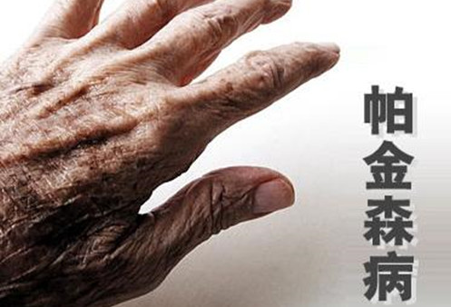 如何运动针对帕金森病有好处,运动可以缓解帕金森症状吗