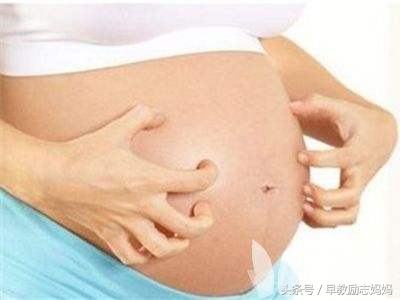 胆汁淤积瘙痒症的症状表现,妊娠期胆汁淤积怎么缓解皮肤瘙痒