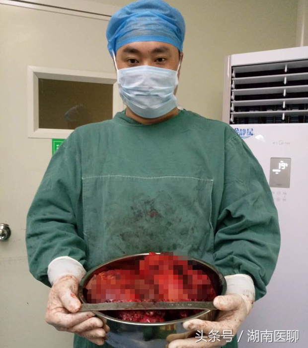 腰部有小肉球是不是有恶性瘤,女三十三岁腰部长了瘤是啥病