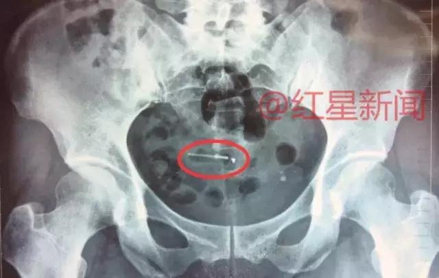 红星调查,红星调查最新视频