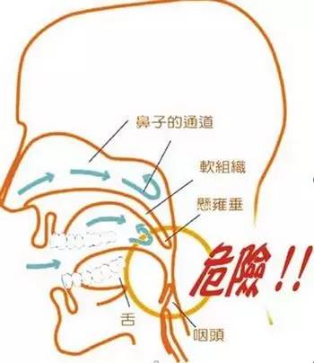 男子打鼾一夜呼吸停断,男人喝完酒打呼噜窒息