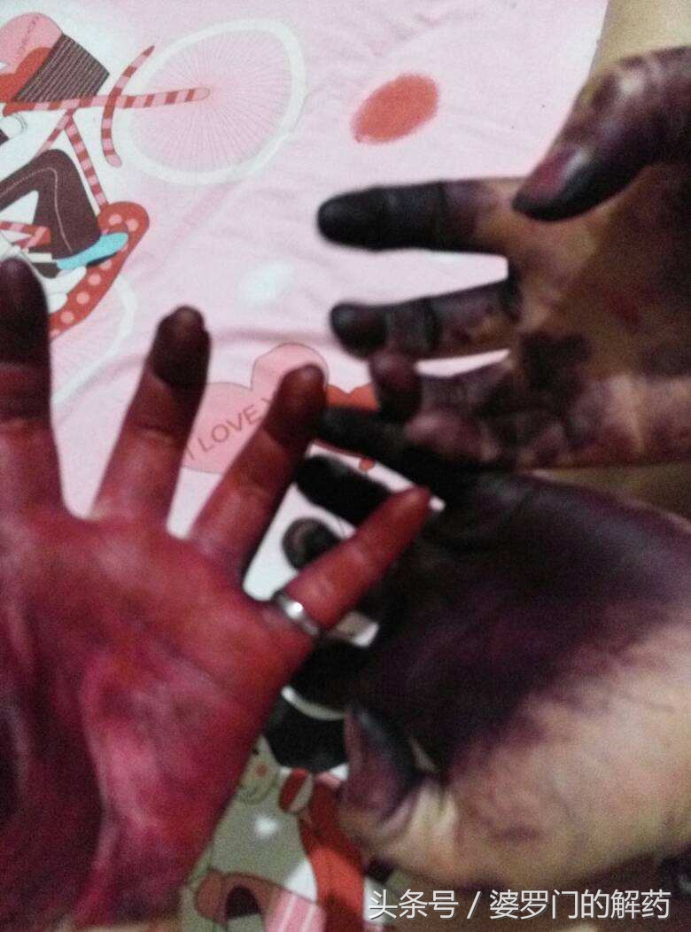 经常染发的女人对身体有害吗,经常染发的女生需要关注以下几点