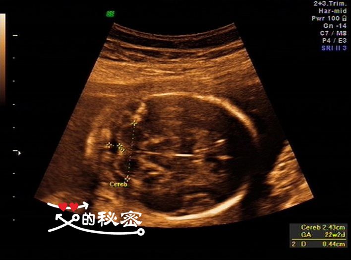 四维空间神秘事件,揭秘四维的存在