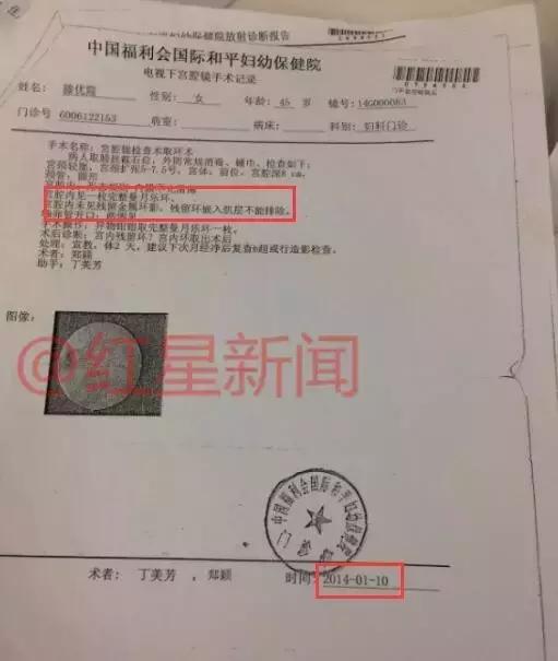 红星调查,红星调查最新视频