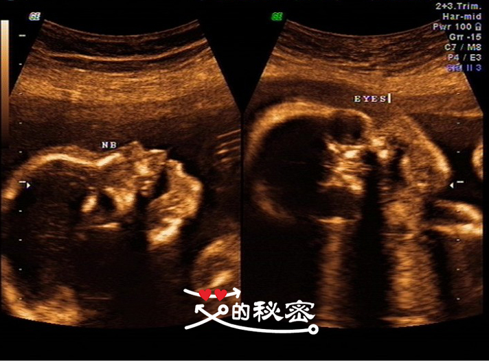 四维空间神秘事件,揭秘四维的存在