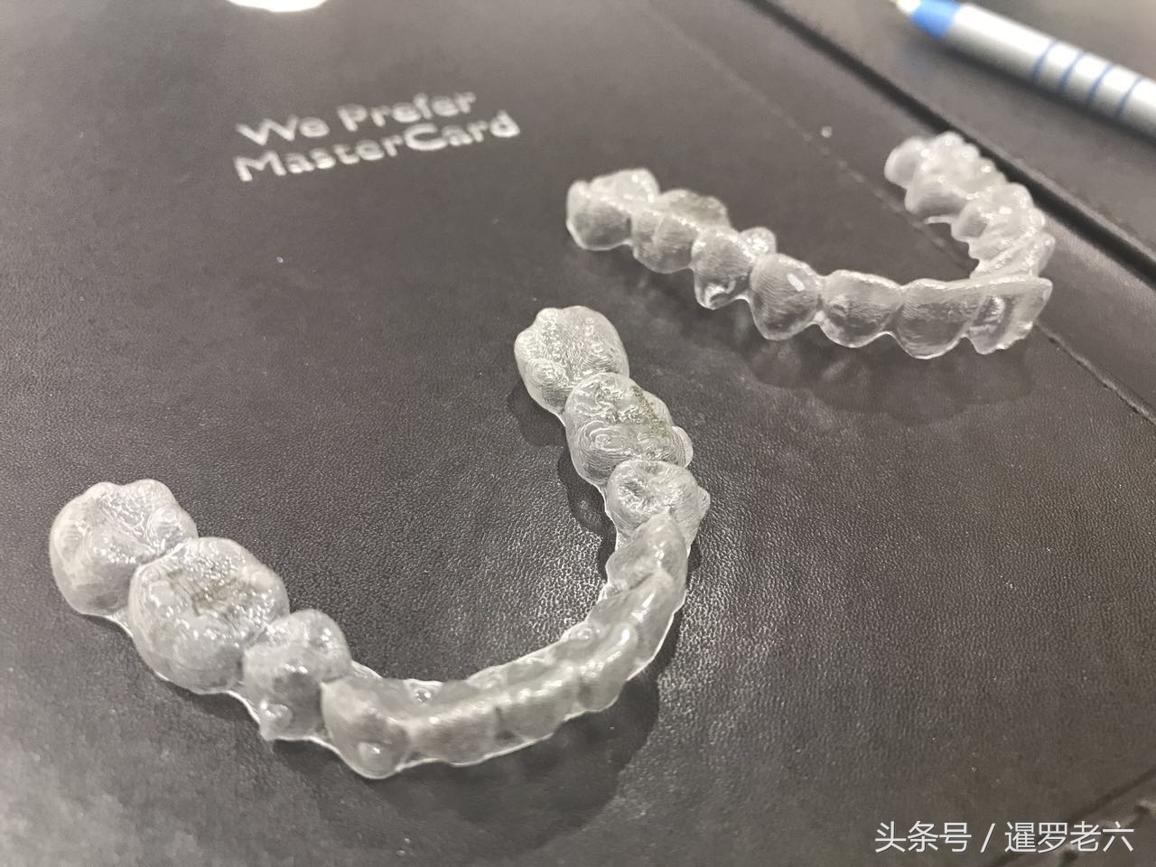 泰国曼谷医院补牙哪家好,在泰国曼谷做美白牙齿价格多少