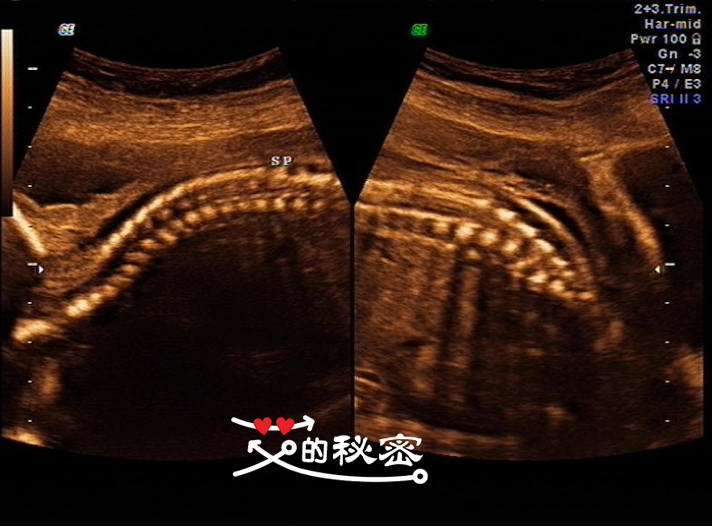 四维空间神秘事件,揭秘四维的存在