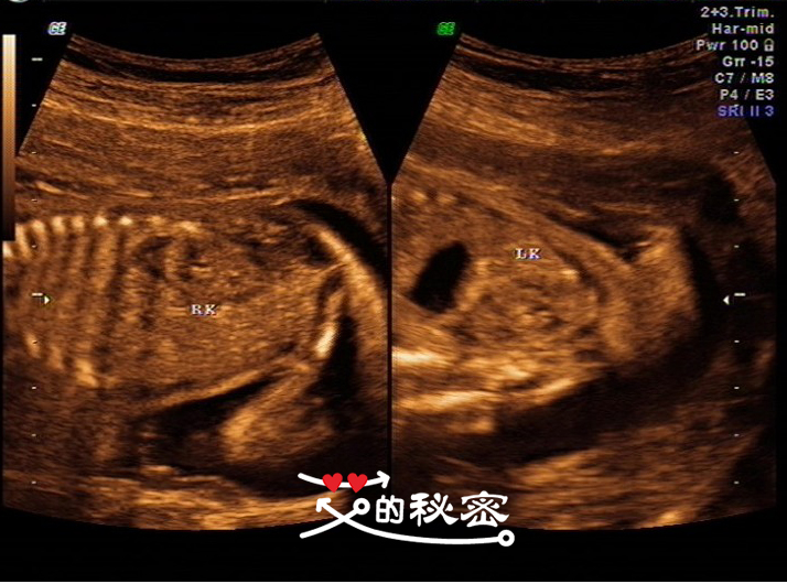 四维空间神秘事件,揭秘四维的存在