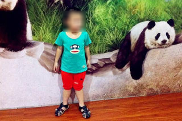 幼儿x型腿怎么办,婴幼儿x型腿走路是什么样子