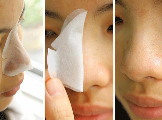 清洁黑头力度大告别草莓鼻,去黑头教程不伤毛孔