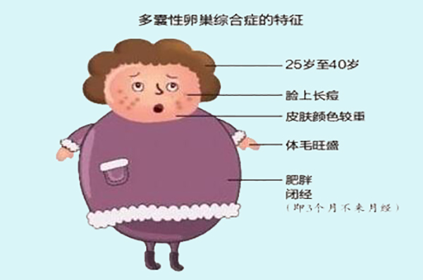 女性检查生育能力检查哪些项目,女性多大生育能力会急剧下滑