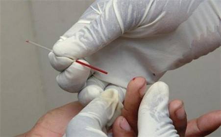 艾滋病患者是不是不能结婚了,艾滋感染者可以结婚吗