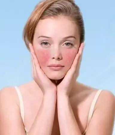 红血丝泛红怎么改善,红血丝肌肤怎么治