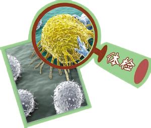 常见癌症筛查的手段,你必须知道的疾病
