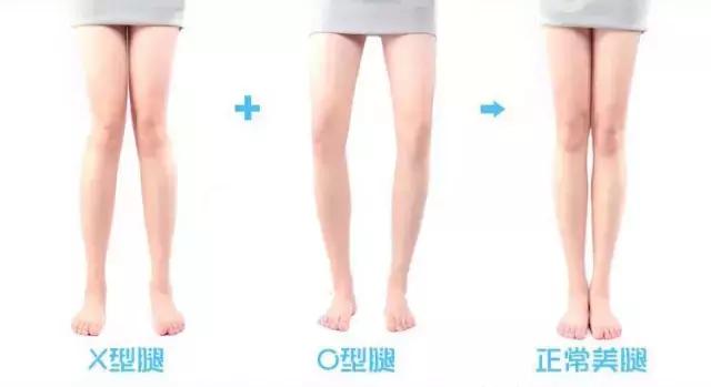 小朋友腿不直怎么矫正腿型,女童腿不直怎么矫正腿型