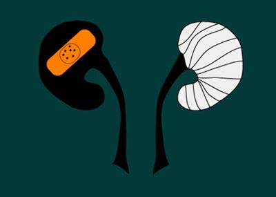 肾癌在多吉美和索坦耐药后可以选择阿昔替尼，但要关注用药风险