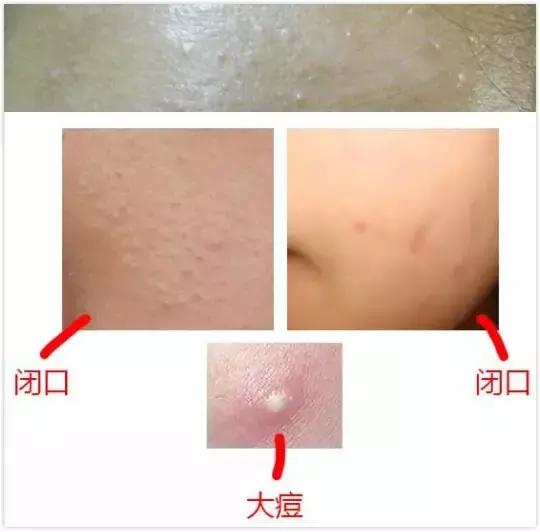 「闭口」这个小婊砸，怎么比现任的前任更难缠！