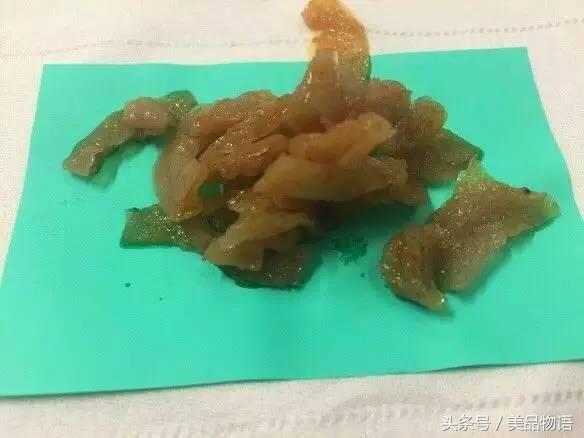 吃100包的辣条就是突破纪录了,连吃十包辣条会怎样