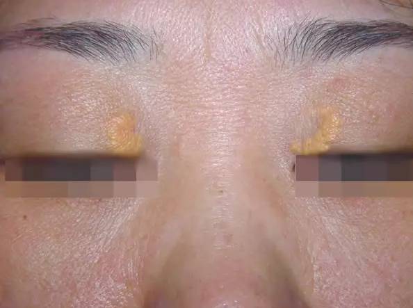 无线合肥早报丨合肥一绿化带里“藏着”200辆破损共享单车