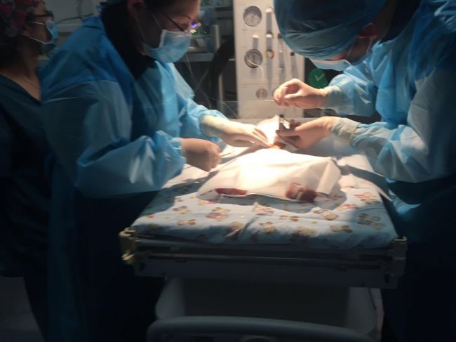 新生儿腹膜透析穿刺,交大一附院透析中心