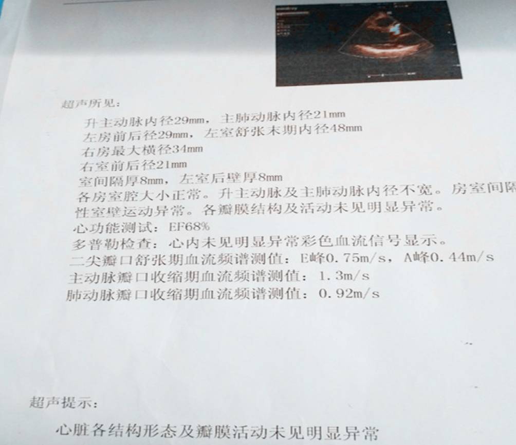 完全性左束支传导阻滞可以治愈吗,完全性左束支传导阻滞能否治愈