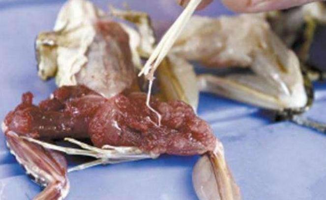 19岁孩子身体萎缩是咋回事,随着年纪增长身体萎缩怎么回事