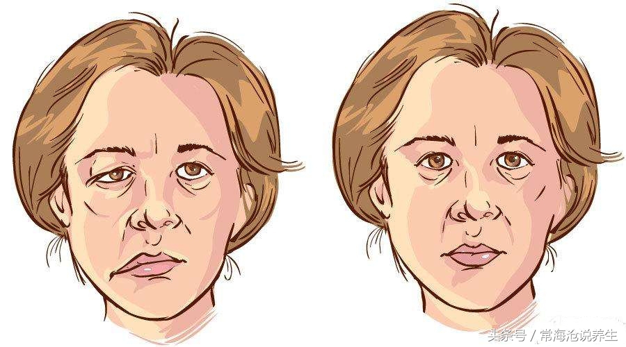 胆囊息肉中医院治疗能消失吗,多发性胆囊息肉怎么治疗比较好
