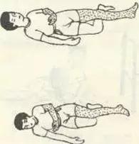 脑梗死锻炼可以恢复双腿无力么,脑梗死运动障碍