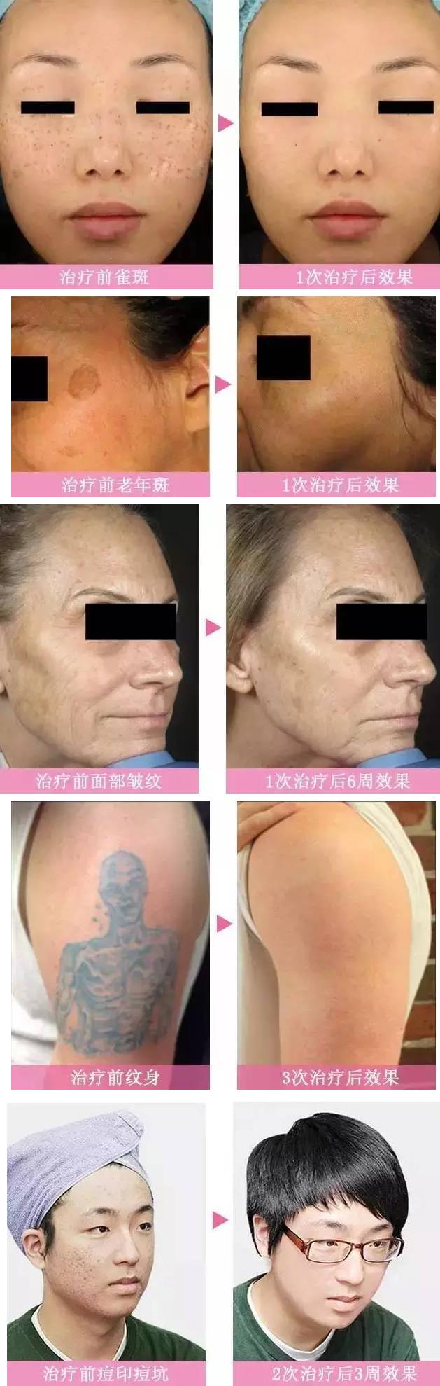 南京韩辰整形皮肤科电话,韩辰整形医院南京广告