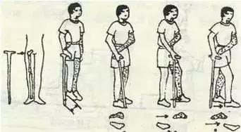 脑梗死锻炼可以恢复双腿无力么,脑梗死运动障碍