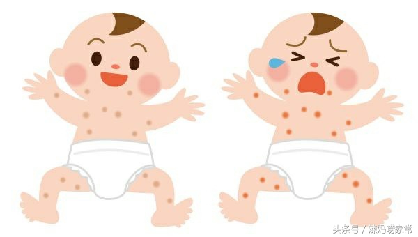 儿保专家：11种婴幼儿湿疹治疗法，家长必读