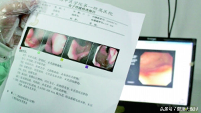 慢性胃炎螺旋杆菌一定要杀吗,慢性胃炎杀灭幽门螺旋杆菌会好吗