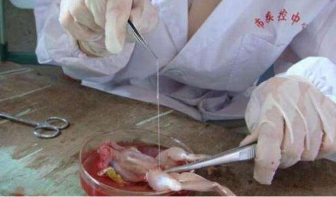 19岁孩子身体萎缩是咋回事,随着年纪增长身体萎缩怎么回事