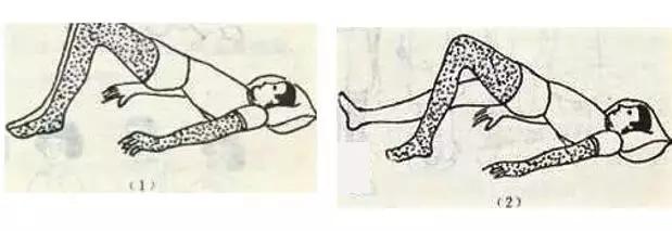 脑梗死锻炼可以恢复双腿无力么,脑梗死运动障碍