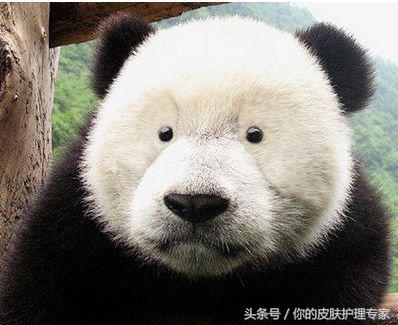 天生黑眼圈怎么化解呢,天生黑眼圈怎么了