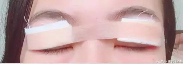 真实贴双眼皮贴,单眼皮怎么贴第二天变双眼皮